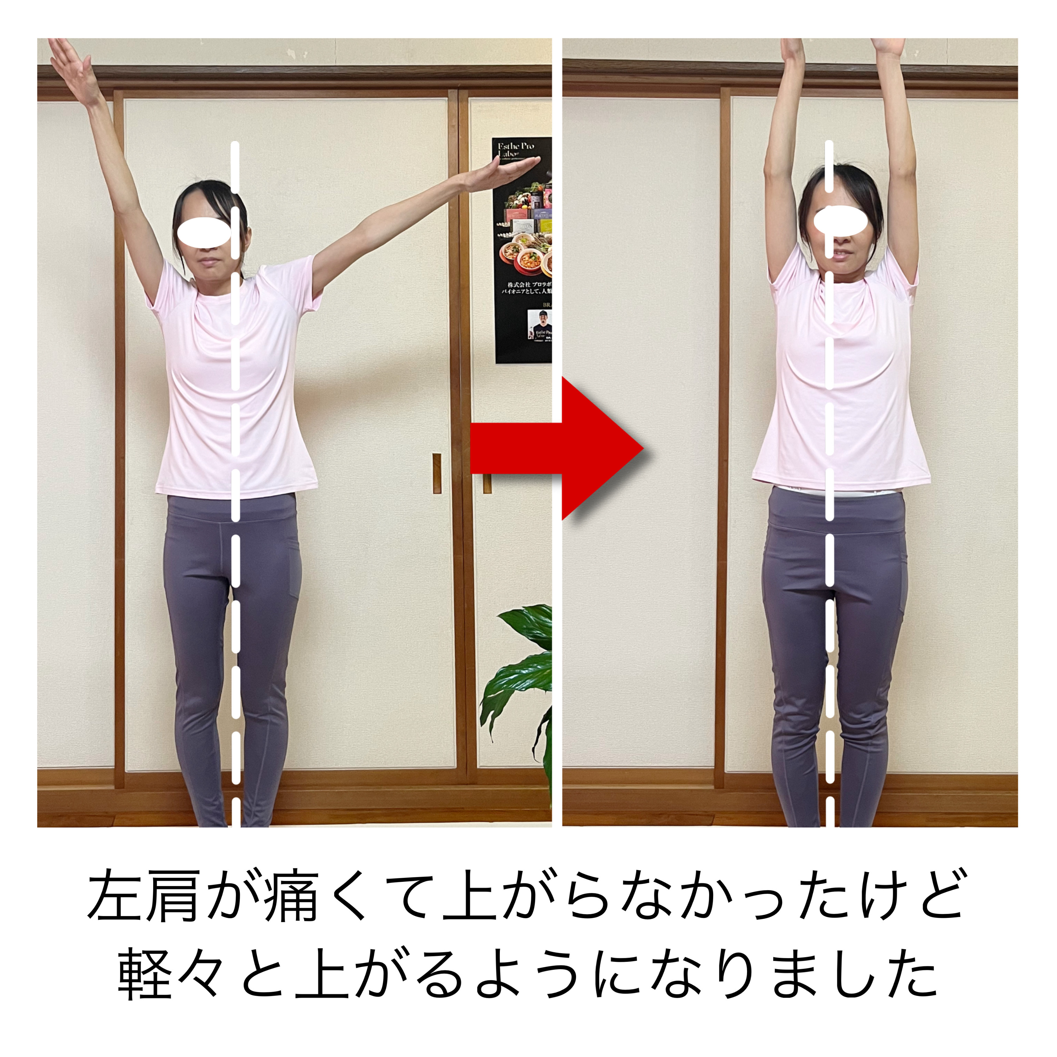 Before/After 1