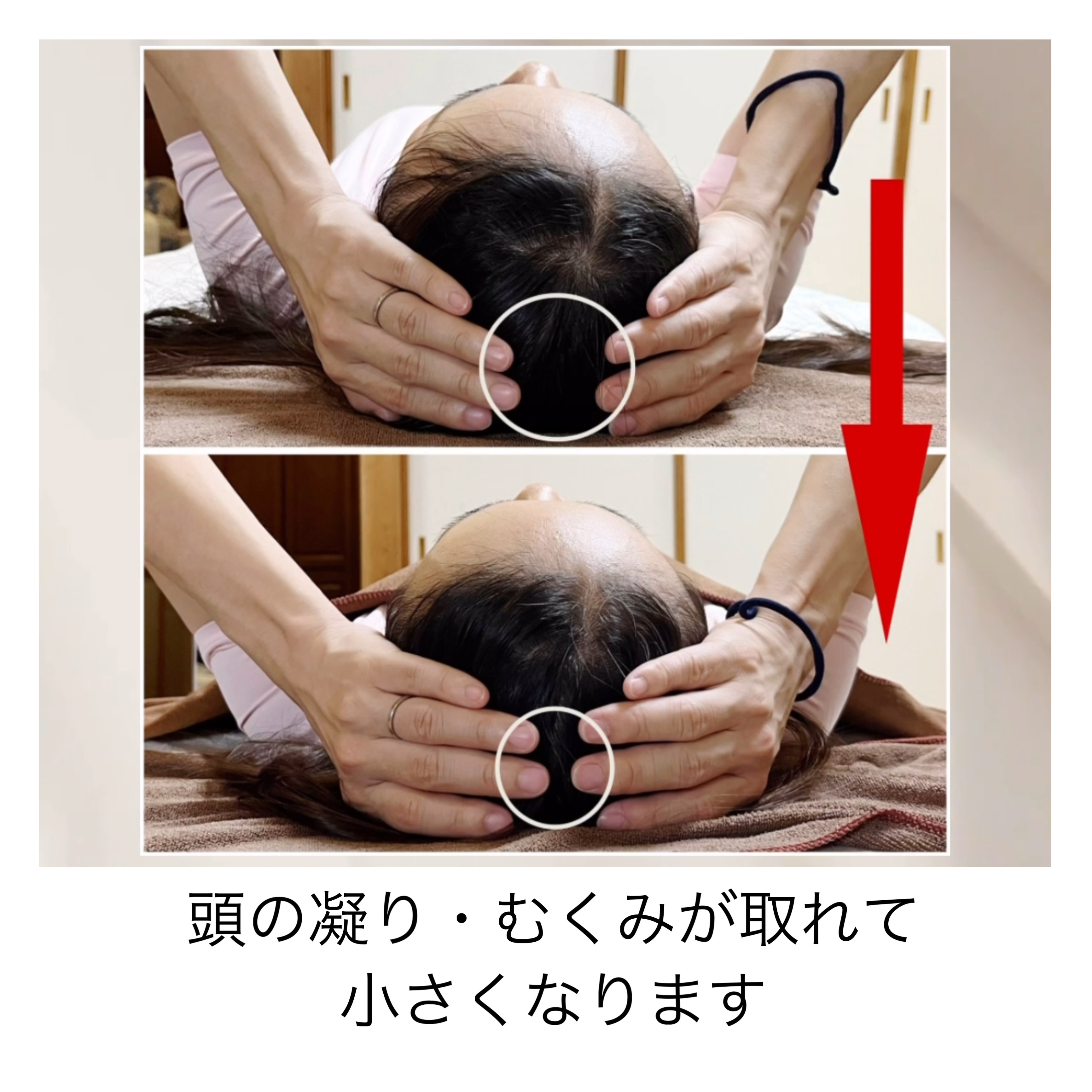 Before/After 10