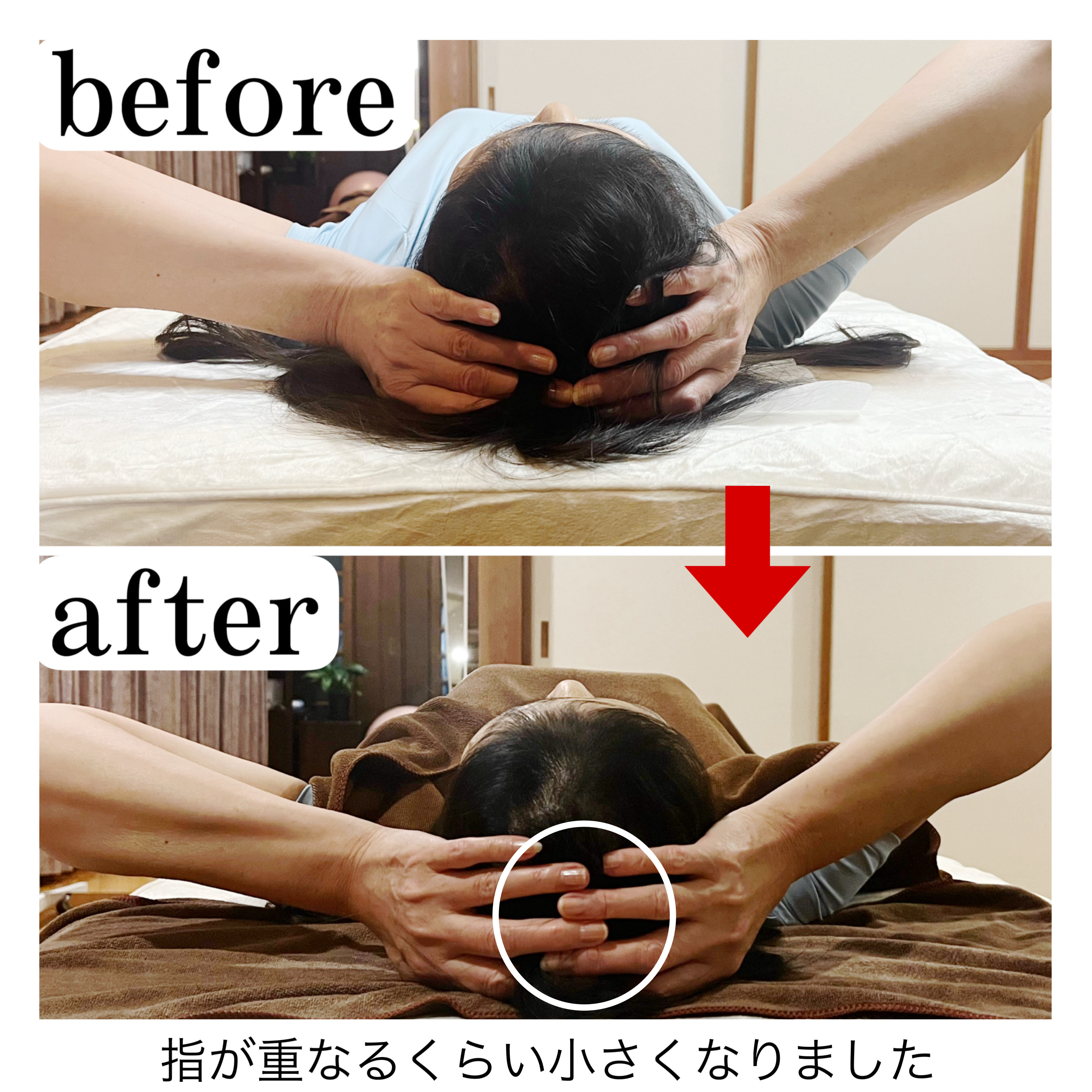Before/After 11