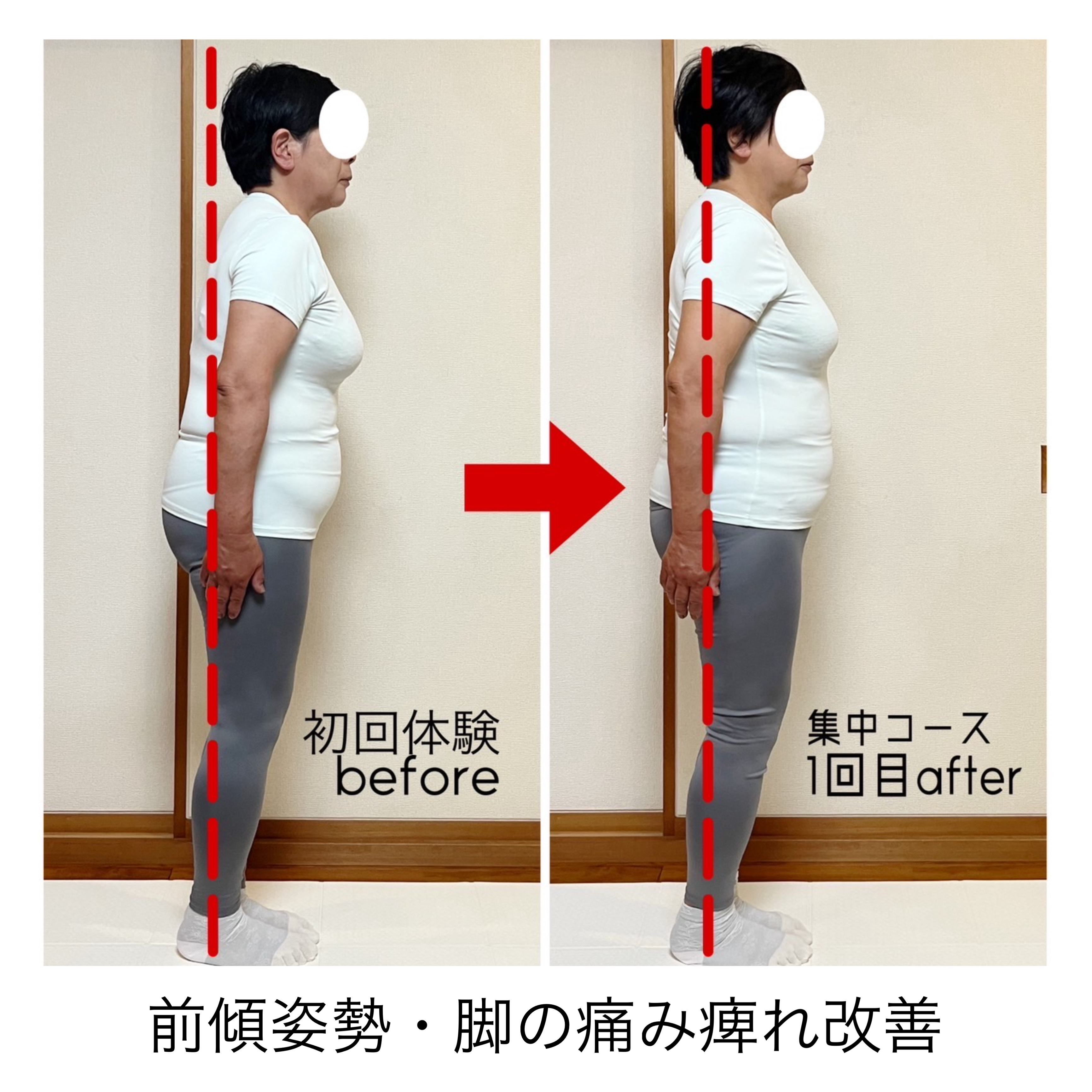Before/After 12