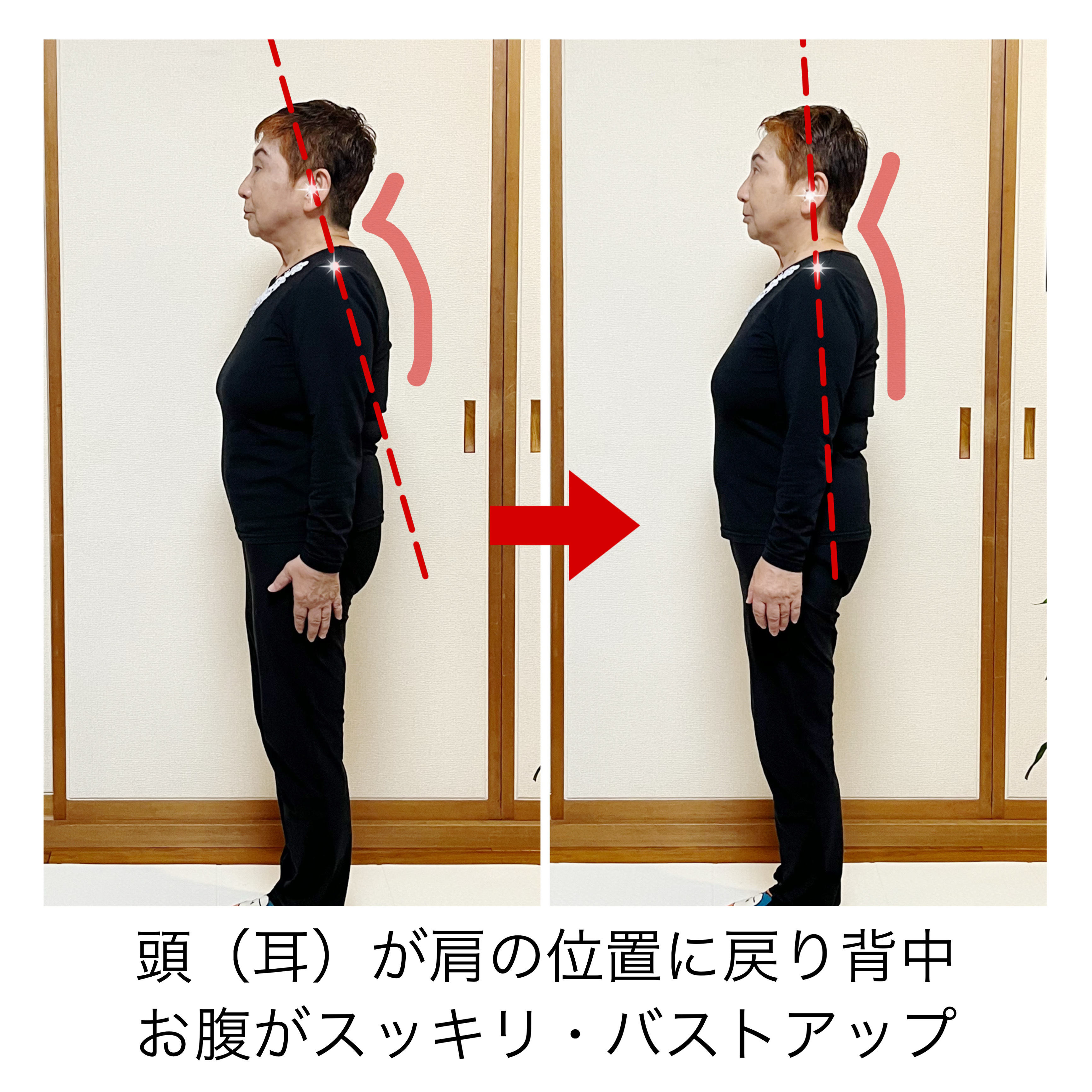Before/After 13