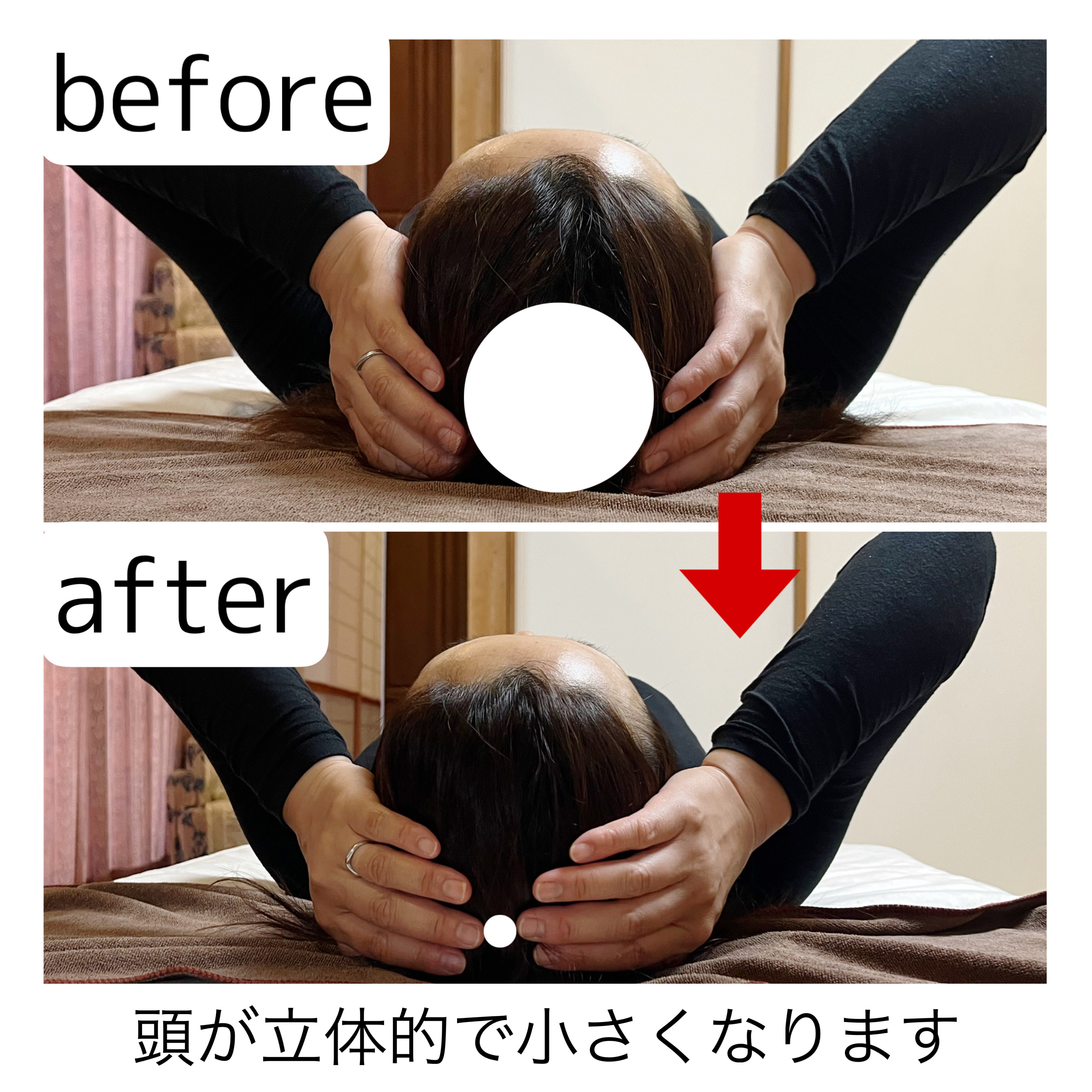 Before/After 14