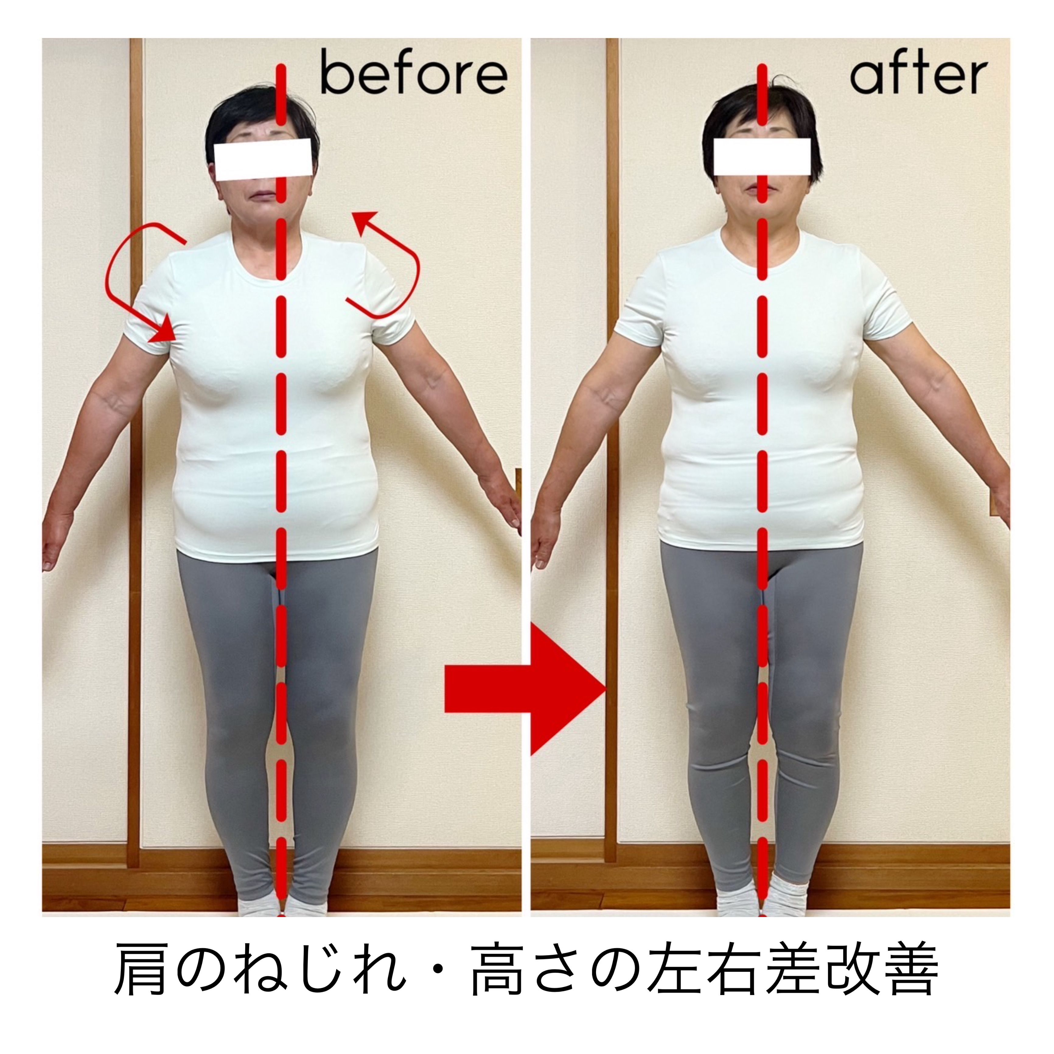 Before/After 2