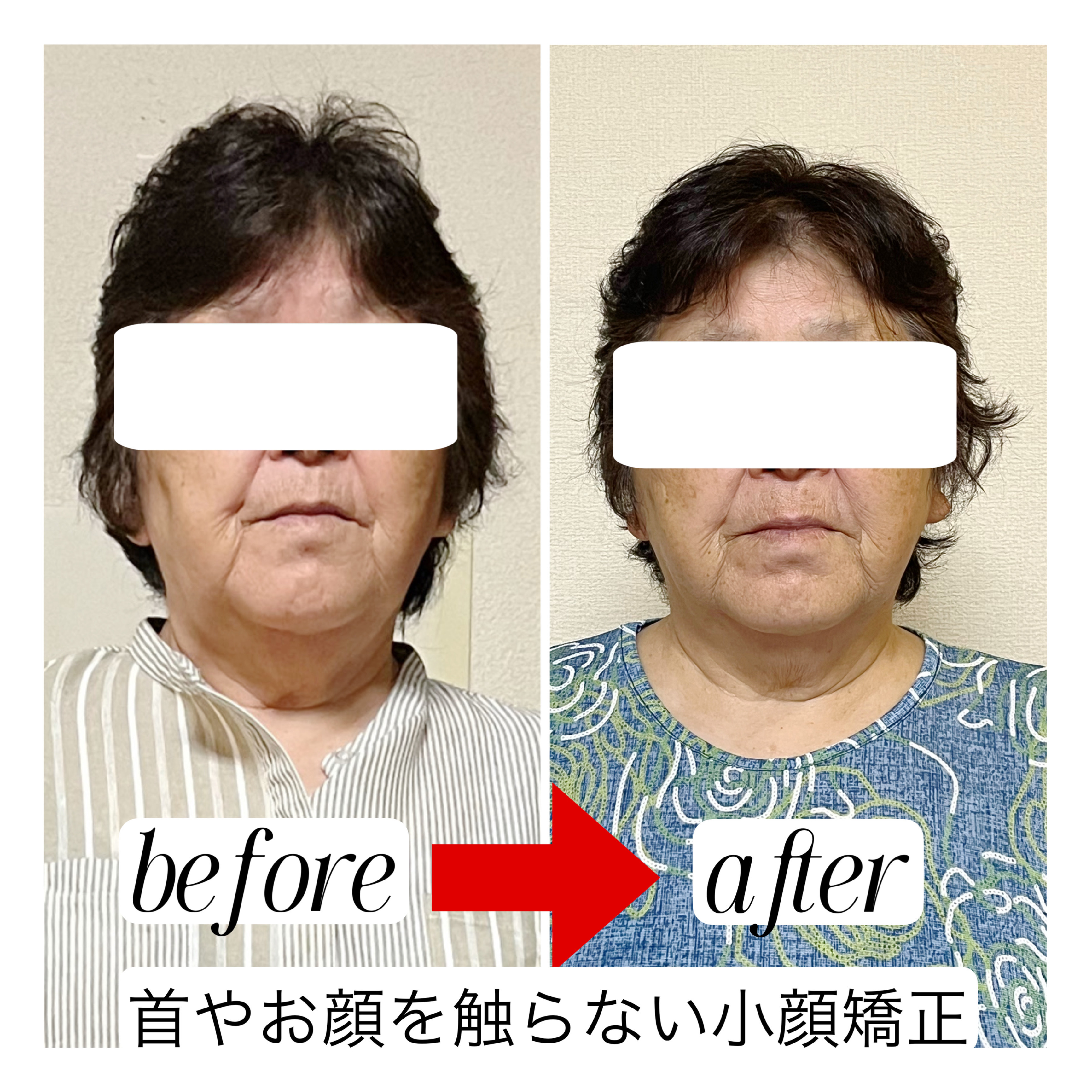 Before/After 3