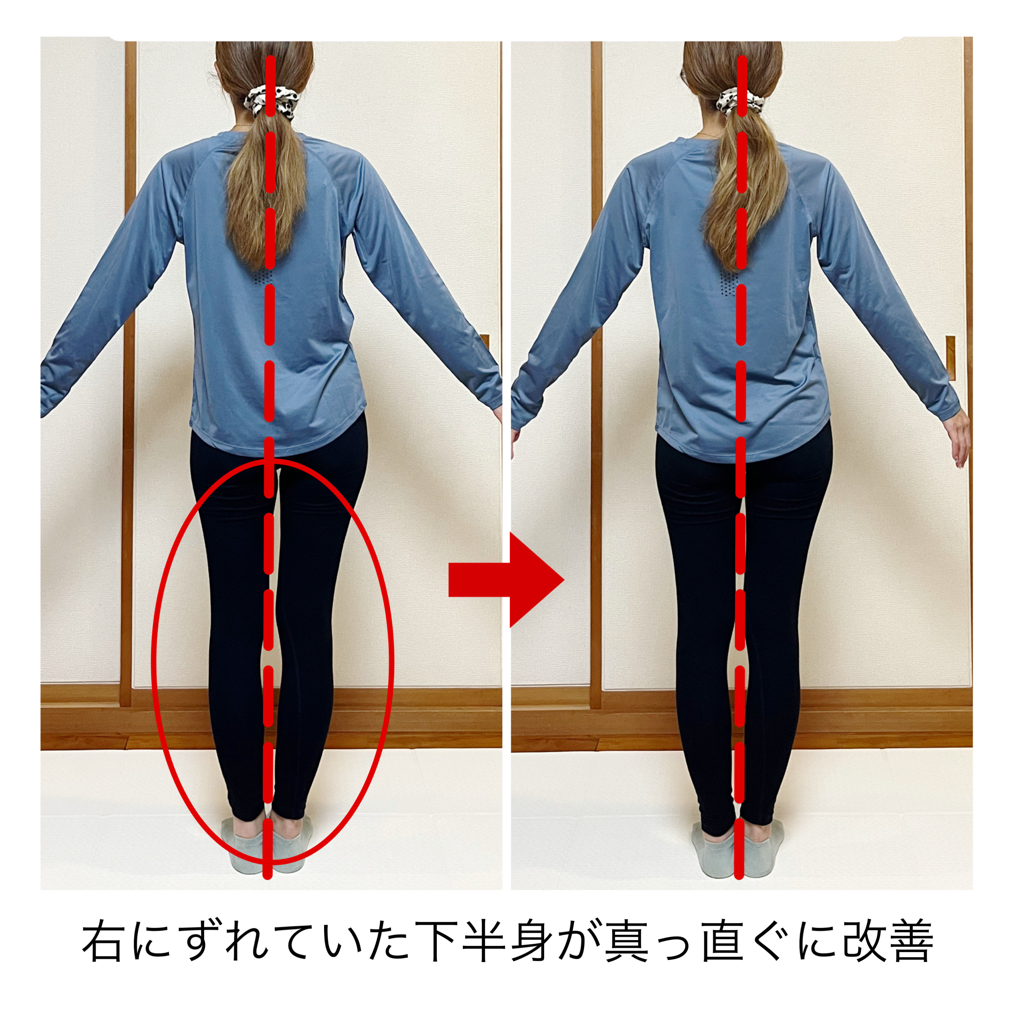 Before/After 4