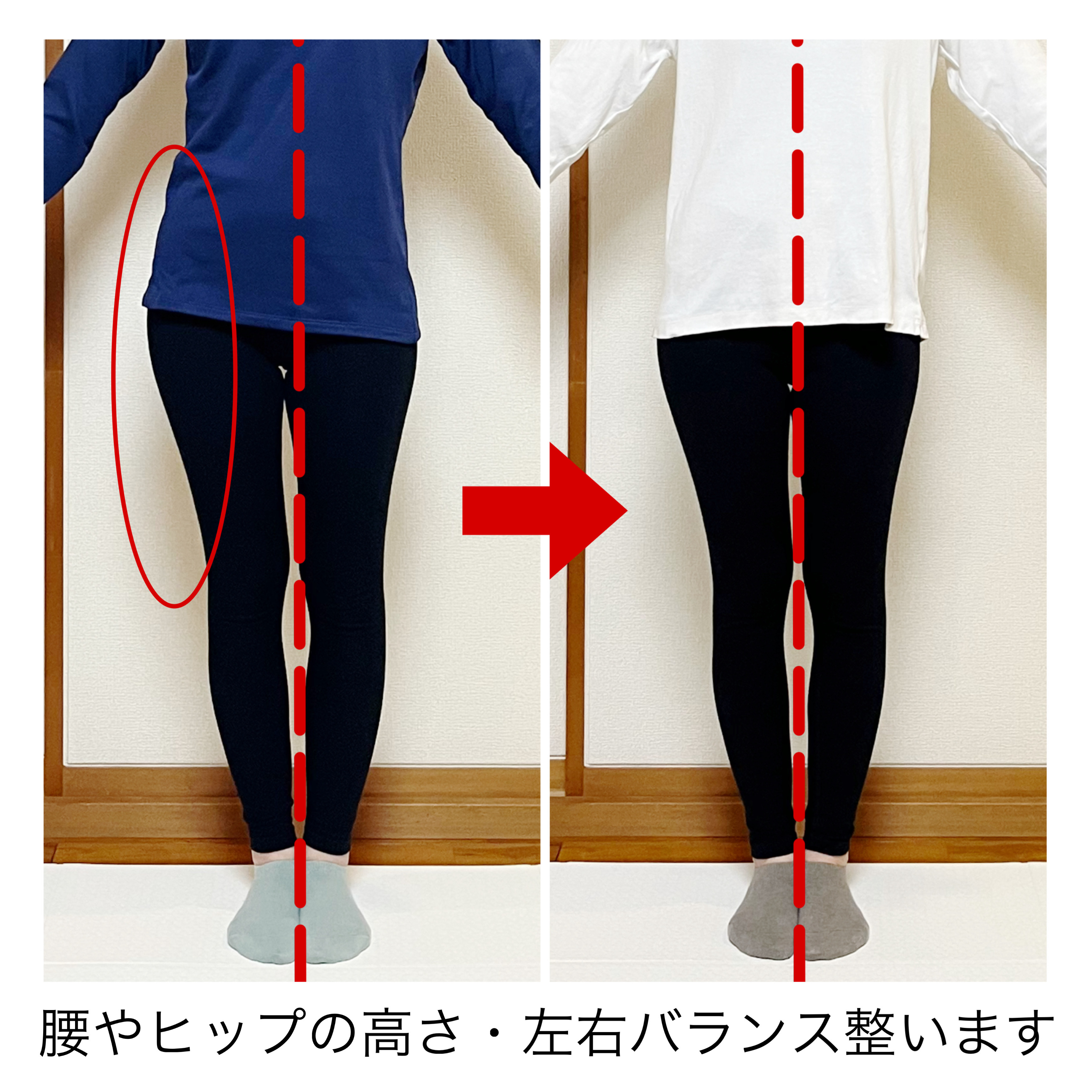 Before/After 5