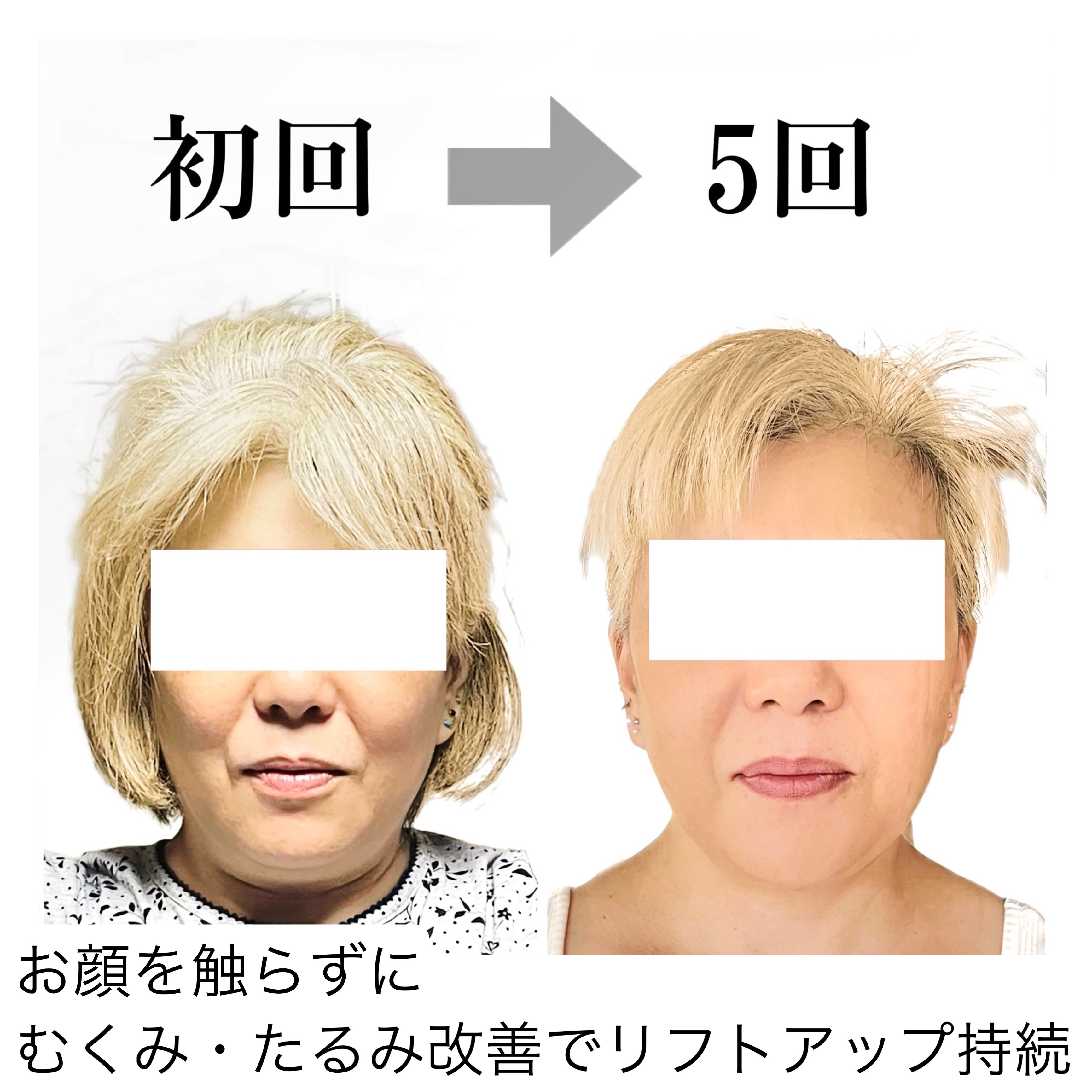 Before/After 6