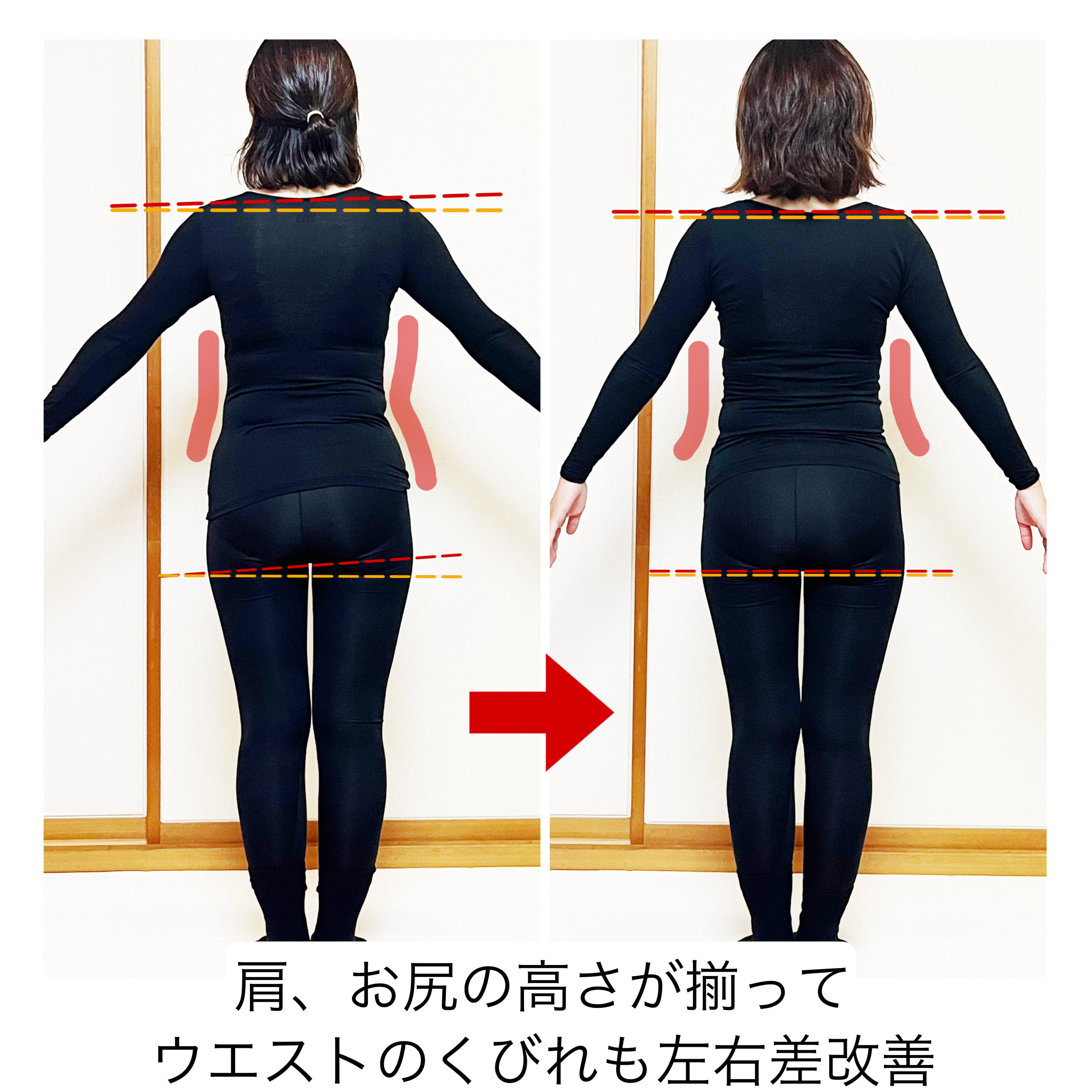 Before/After 9